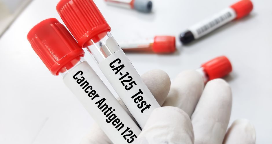Pruebas diagnósticas en la detección del cáncer